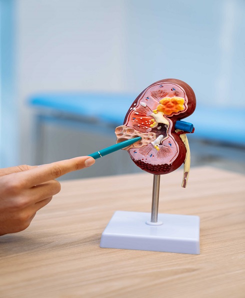 Expert Kidney Specialists in Hanamkonda