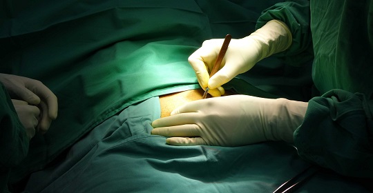 Hernia, Appendix & Gallbladder Surgeries